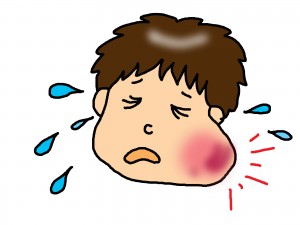 おたふく風邪に中学生がかかったら？症状や合併症は？予防接種はすべき？